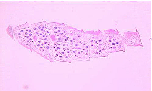 September - 2007 - Case #212