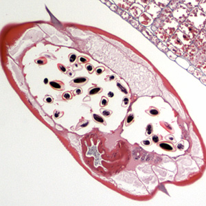 October - 2007 - Case #213