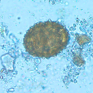 An asymptomatic, 35-year-old male with no known travel history went to his physician at a wellness clinic for a routine examination. Unusual objects were observed in the formalin-concentrated stool, and the specimen was sent to CDC for diagnostic assistance and possible identification. 