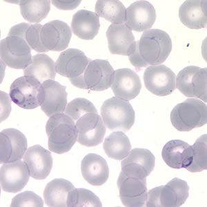 December - 2007 - Case #217