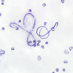 February - 2008 - Case #222