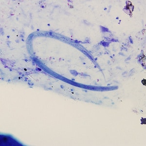 A 32-year-old Latin American man sought medical attention for persistent fever and cough. A sputum specimen was collected for testing. Smears were prepared and stained with Giemsa. 