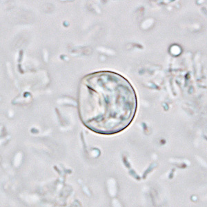 August - 2008 - Case #233