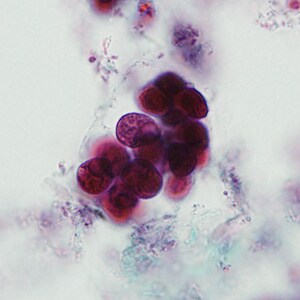 A 28-year-old man had loss of appetite, weight loss, and intermittent diarrhea approximately one week after attending a family reunion located on a farm in the mid-western U.S. He sought medical attention with his primary care provider who collected a stool specimen for ova and parasite (O&P) examination using a single-vial fixative system. 
