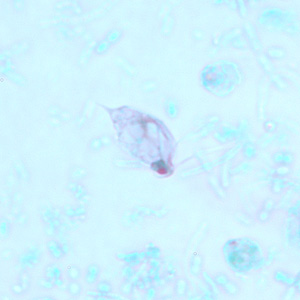 November - 2008 - Case #239