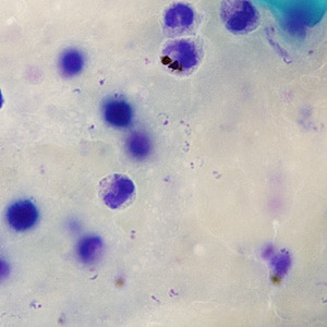 A 64-year-old man returned from a trip to Africa with fever and chills. He went to a local hospital for medical assistance. A blood specimen was collected and sent to Hematology for work-up, including Parasitology.