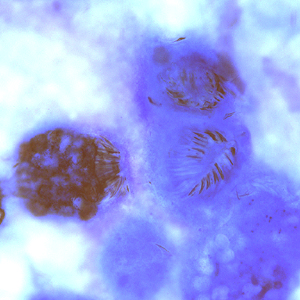 March - 2009 - Case #247