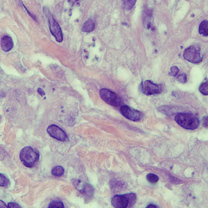 April - 2009 - Case #250