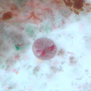 Case251_C.jpg