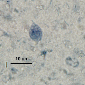 May - 2010 - Case #276