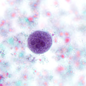 July - 2010 - Case #280