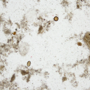 August - 2010 - Case #281