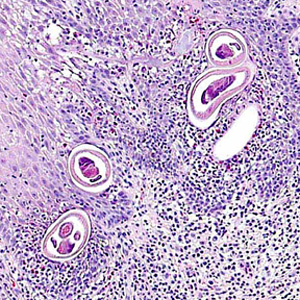 September - 2010 - Case #283