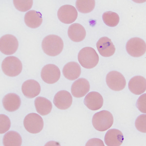 November - 2010 - Case #287