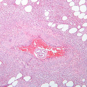 December - 2010 - Case #289