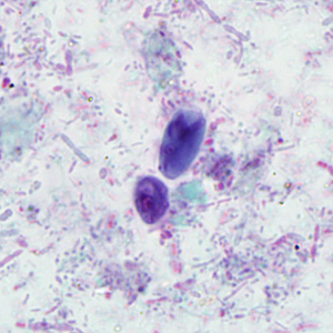 February - 2011 - Case #293