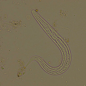 February - 2011 - Case #294