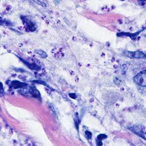 April - 2011 - Case #298