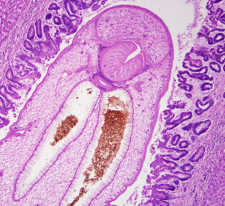 May - 2011 - Case #299