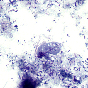 July - 2011 - Case #303