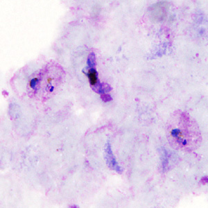 August - 2011 - Case #306