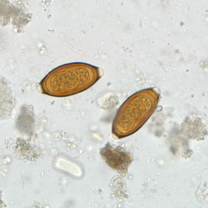 September - 2011 - Case #307