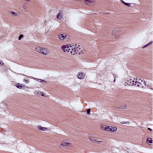 September - 2011 - Case #308