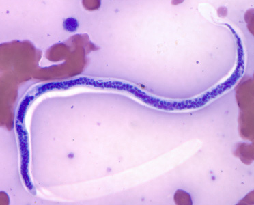 November - 2011 - Case #311