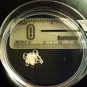 December - 2011 - Case #314