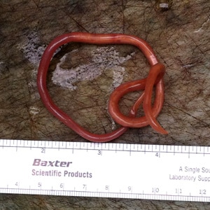 A 31-year-old man, originally from Ecuador, vomited what appeared to be a long worm-like object. The object measured 27 centimeters in length. 