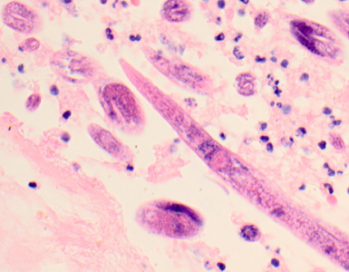 March - 2012 - Case #319