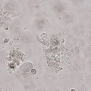 April - 2012 - Case #321