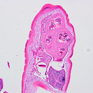 June - 2012 - Case #326