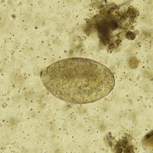 A seven-year-old boy had an ova-and-parasite (O&P) stool examination performed as part of a required refugee screening. Laboratorians at the state health department observed what they believed to be a few eggs within the size range of 110-120 micrometers.