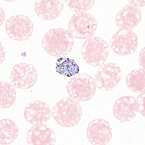 August - 2012 - Case #330