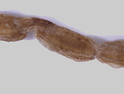 September - 2012 - Case #332