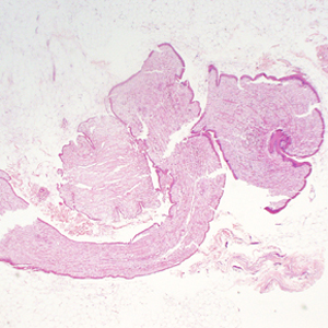 October - 2012 - Case #333