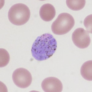 A state health laboratory received Wright-stained blood films for malaria confirmation and identification. The patient had most-recently traveled to Pakistan (but had been in the U.S. for the past nine months without additional international travel). 