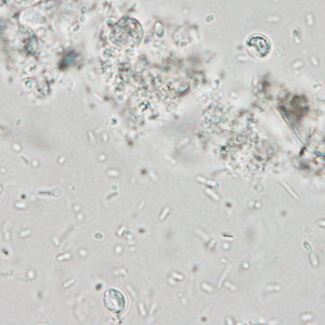 December - 2012 - Case #337