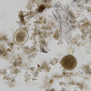 December - 2012 - Case #338