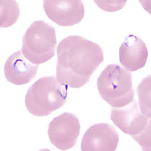 June - 2013 - Case #350