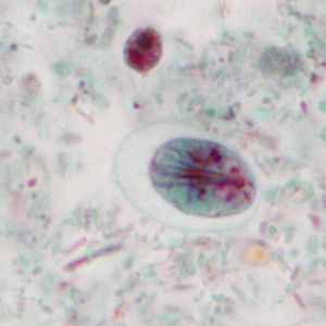 July - 2013 - Case #351