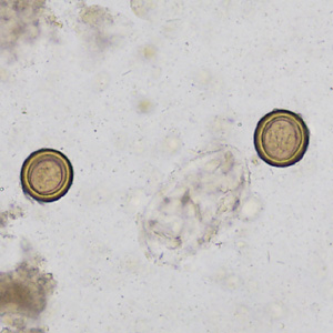 October - 2013 - Case #358