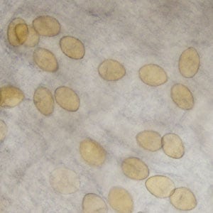 parasite eggs in stool