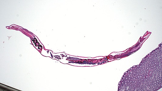 A worm-like object was observed during a routine colonoscopy screening of an adult living in Hawaii. The specimen was collected, sectioned, and stained with hematoxylin-and-eosin (H&E).