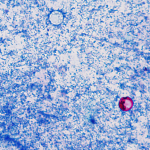 June - 2014 - Case #374