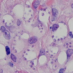 August - 2014 - Case #378