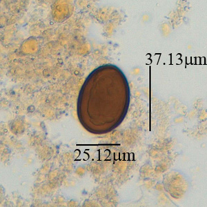 October - 2014 - Case #381