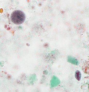 For the last Monthly Case Study for 2014, the DPDx Team thought we would fill your holiday stockings with a plethora of parasites! The following images were taken from a trichrome-stained stool specimen collected from a Haitian refugee. The original report documented several intestinal protozoa. How many can you identify?