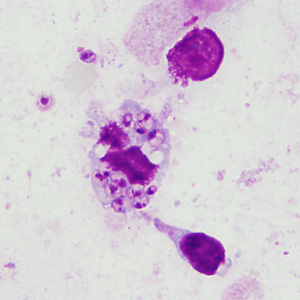 April - 2015 - Case #394